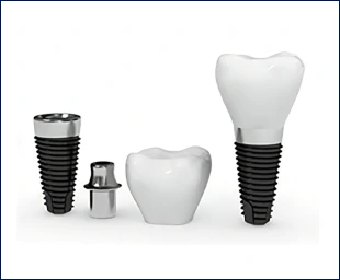 Implantable prototypes